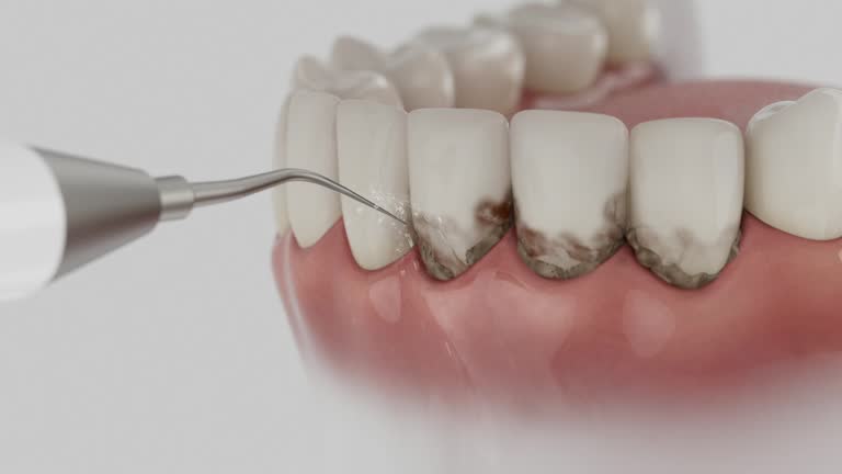 Trusted Wisdom Tooth Removal service in Ruckersville, VA - Dentist Open Now